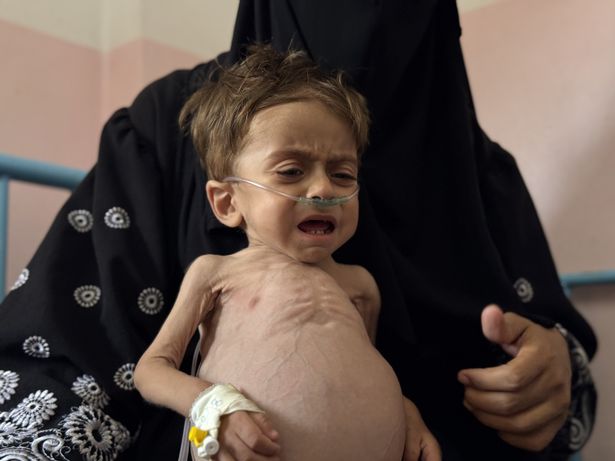كريم ماممر يتلقى العلاج في مستشفى ناصر في خان يونيس