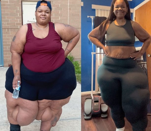 Jameka Mauldin قبل وبعد