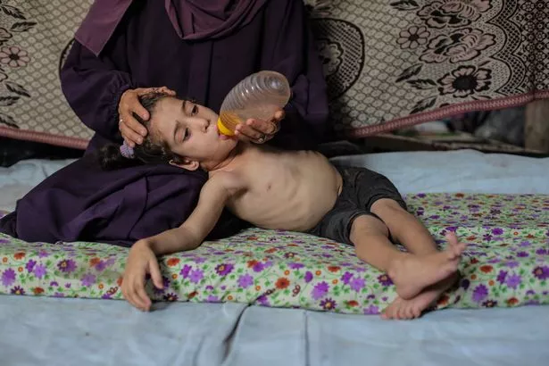 داليا محمد المحمد الزويدي ، البالغة من العمر خمس سنوات ، يتم تغذيتها بزجاجة