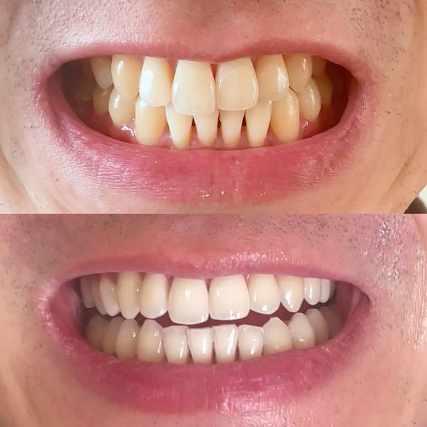 قبل وبعد أن يستخدم العميل منتجات mysweetsmile