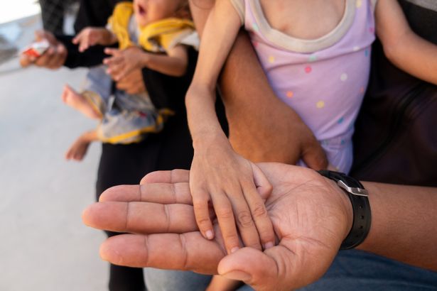 يد فتاة سوء التغذية ، مع ذراعي رقيقة ، تستريح على والدها.