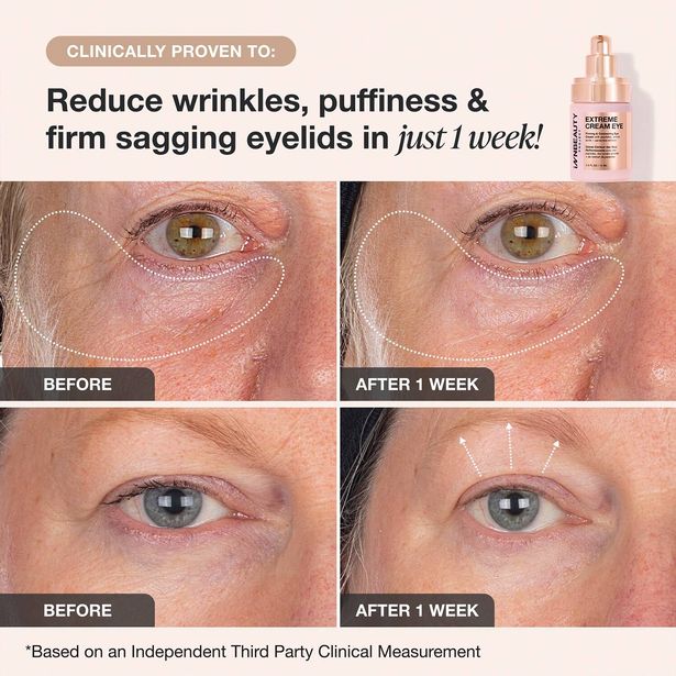 Innbeauty Project Cream Extreme Firming & Contouring Creame Ewlable Eye Cream
