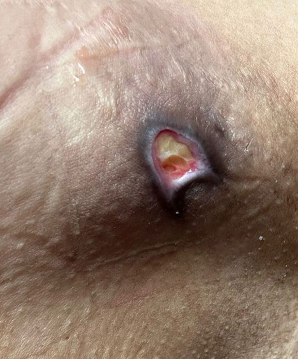 يجب تنفيذ الإجراءات التجميلية فقط من قبل الموظفين المدربين طبيا