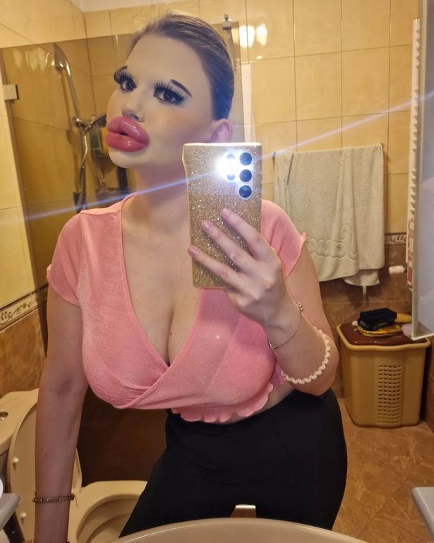 حذر الطبيب حذر الطبيب من الإفراط في الإرهاق المتكرر للشفاه والوجه. 