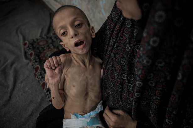 نافيز محمد خدر ناصر ، عشرة ، بالكاد يمكنه المشي عبر الجوع.