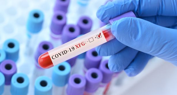 حالات Covid أعلى مستوى هذا العام