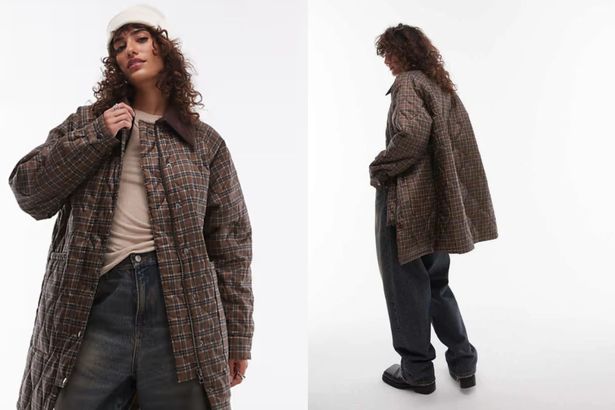 Topshop تحقق من معطف النايلون الطويل مع طوق الحبل