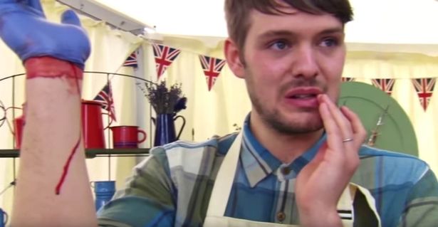 كان جون وايت في مركز الدراما عندما تمكن من تقطيع إصبعه مفتوحًا في فعل صنع Strudel. هو