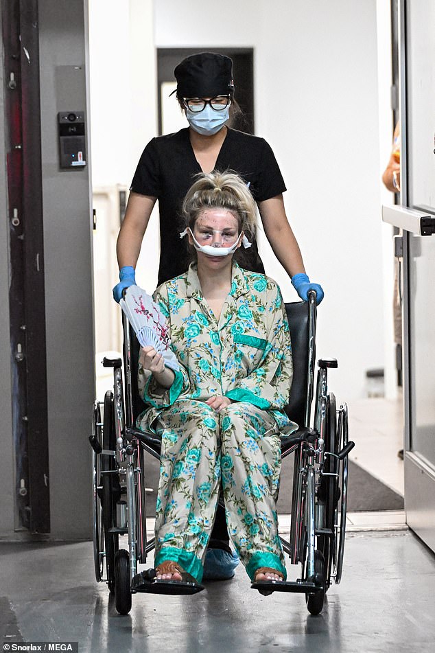 بدا وجهها منتفخًا وكدمات ، مع كلتا عيناها مغلقة تقريبًا بسبب التورم