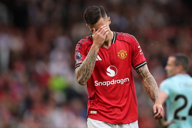 بنيامين سيسكو خلال MAN UTD مقابل Burnley