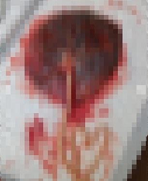 قام بتضمين صورة بيانية لمشيمة فيك، والتي تحولت لاحقًا إلى حبوب، في منشوره