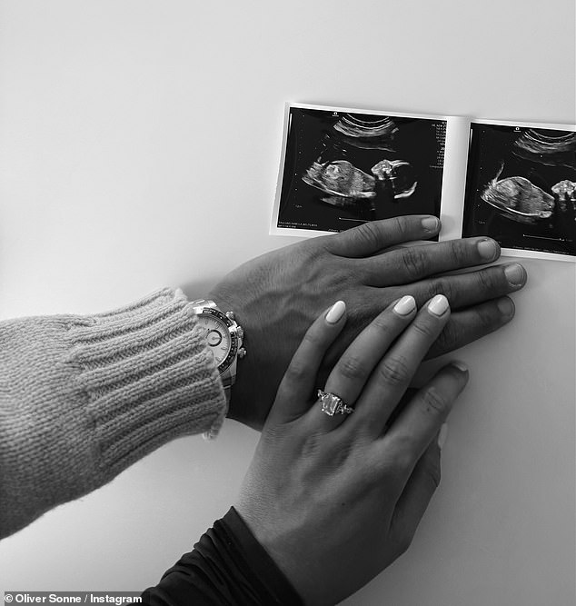قام الزوجان أيضًا بقص صورة من مخطط الموجات فوق الصوتية الخاص بهما