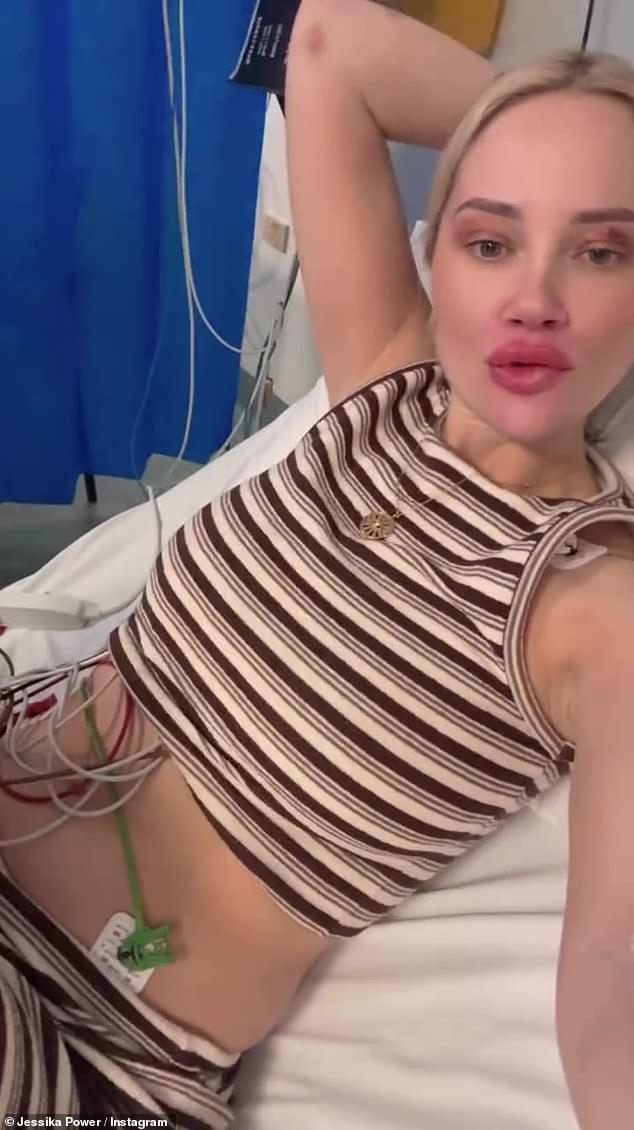 نشرت نجمة OnlyFans البالغة من العمر 32 عامًا على Instagram يوم الأربعاء مقطعًا حيث يمكن رؤيتها مستلقية على نقالة مع أنابيب متصلة ببطنها