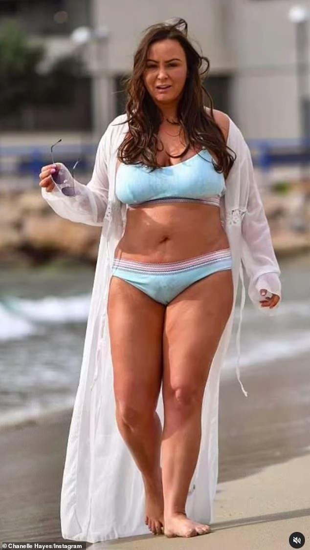 نجمة الواقع، التي ذاعت شهرتها في برنامج Big Brother على القناة الرابعة في عام 2007، شهدت وزنها يتراوح بين سبعة و17 حجرًا على مدى السنوات الأربع الماضية (في الصورة قبل الجراحة)