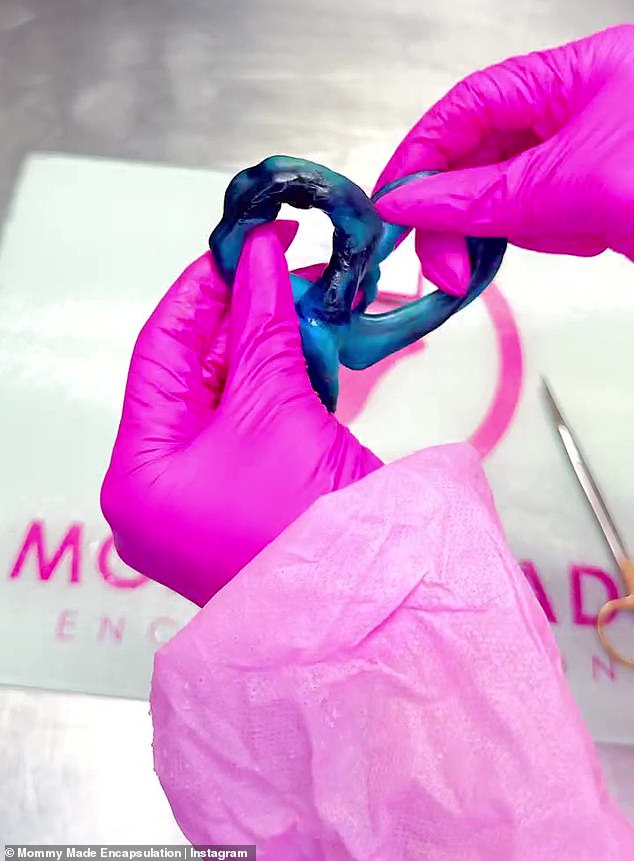 تم ربط الحبل السري المصبوغ باللون الأزرق من خلال سلك على شكل قلب