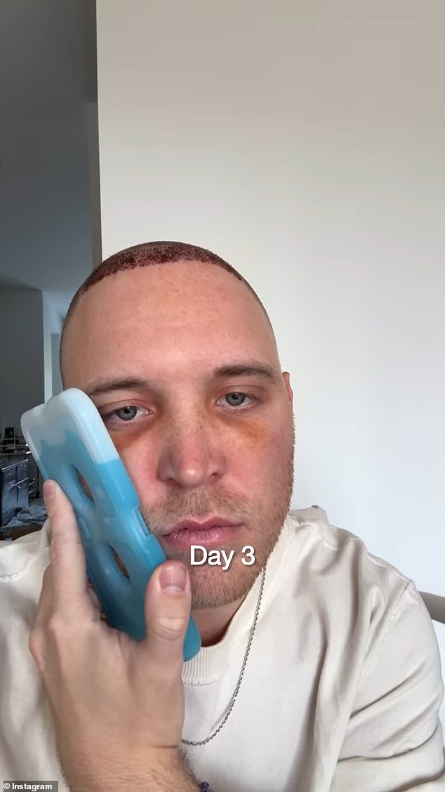 وقام بتوثيق العملية على وسائل التواصل الاجتماعي الخاصة به