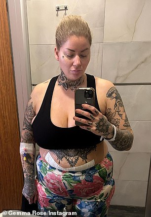 خضعت جيما لعملية جراحية لتكميم المعدة بعد أن غيرت حياتها وشاركت صورًا لفقدان وزنها (في الصورة بعد الجراحة)