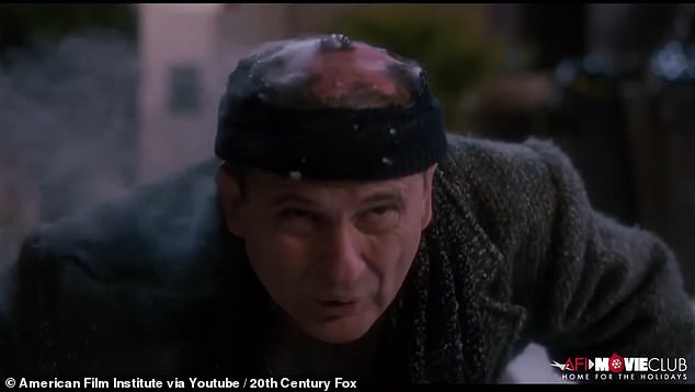 كشف Pesci منذ ذلك الحين أنه أصيب بحروق خطيرة بسبب هذه الحيلة