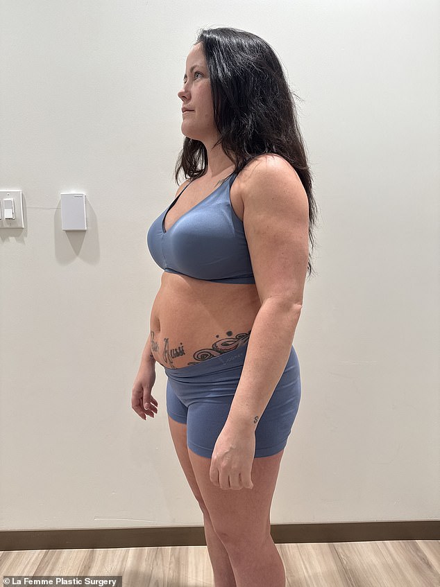 وأوضحت أنها بحثت عن جراح تجميل بعد أن أنجبت ثلاثة أطفال وواجهت صعوبة في التخلص من 