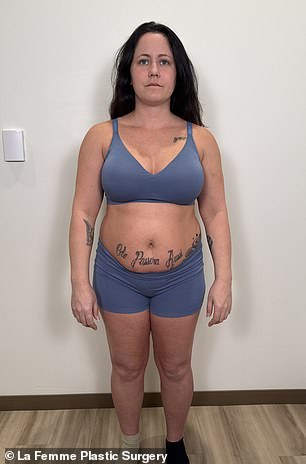 شاركت نجمة تلفزيون الواقع البالغة من العمر 33 عامًا الصور قبل وبعد تعافيها من الجراحة التي أجرتها في وقت سابق من هذا الشهر.