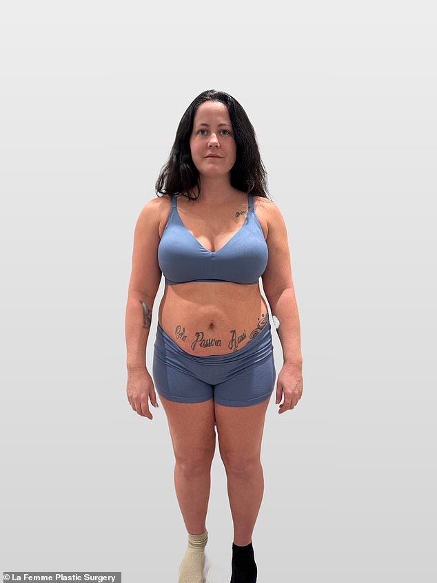 وقالت أيضًا إنها تريد أن تكون شفافة بشأن إجراء الجراحة للأمهات الأخريات