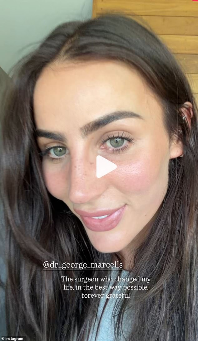 هذا الشهر، كشفت إندي لأول مرة عن نتائج عملية تجميل أنفها الثانية ولا يستطيع معجبوها الاكتفاء من المظهر الجديد للمؤثرة.