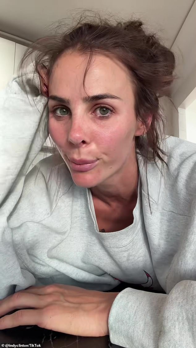 قامت إندي مؤخرًا بإبلاغ معجبيها بقرار مراجعة عملية تجميل أنفها الأصلية (في الصورة)