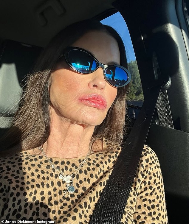 تدعي جانيس الآن أن قناة ITV مسؤولة قانونًا عن دفع التعويضات، وأضافت المصادر أن العارضة تعتقد أن مزيجًا من أدوية النوم والمخيم المظلم أدى إلى سقوطها.