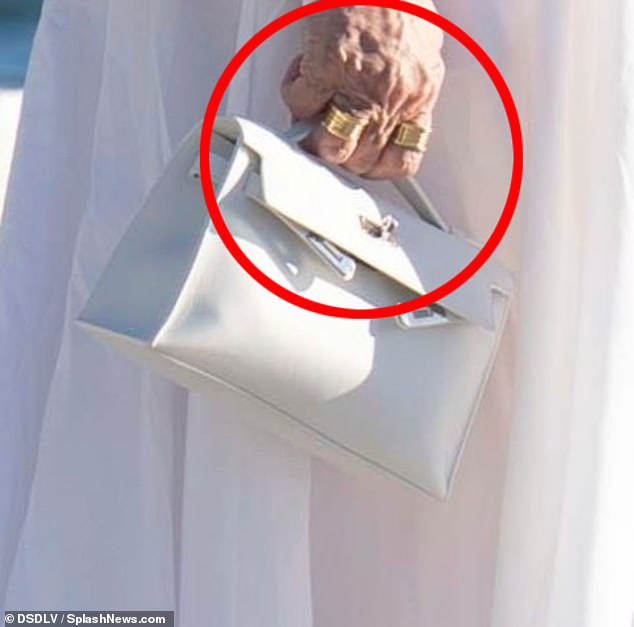 لكن الأطباء يقولون حصريًا لصحيفة ديلي ميل إن محاولة ما يسمى بـ 