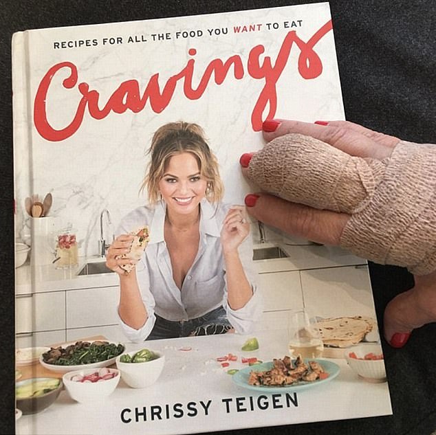 في عام 2016، أثارت جينر تكهنات جديدة عندما شاركت صورة على إنستغرام تظهر يدها مغطاة بالضمادات، مما أثار على الفور أحاديث حول نوع الإجراء الذي ربما خضعت له.