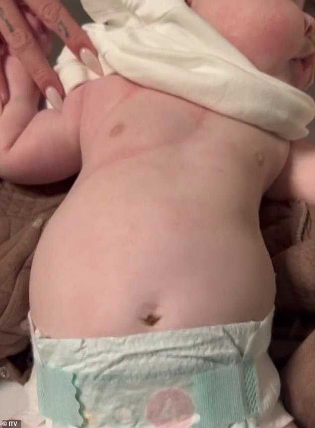 وقالت جيسي، وهي تشيد بوالدتها لاكتشافها العلامات، إنها تجاهلت مخاوف والدتها من كونها 