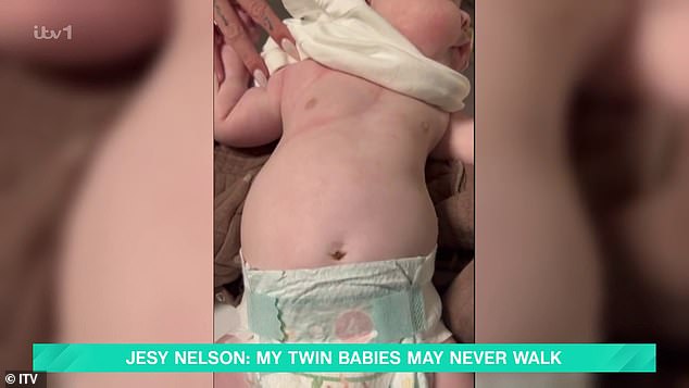 وعرضت مقطع فيديو لإحدى الفتيات وهي تتنفس وهي تشرح 