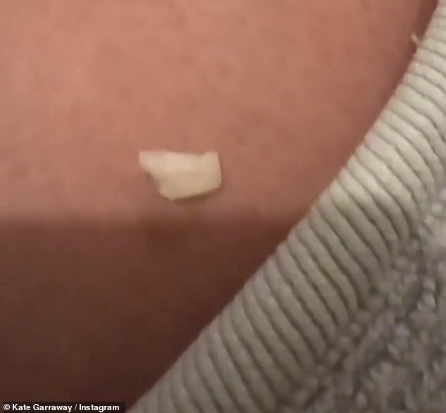 وصفت النجمة المروعة كيف اضطرت إلى لصق أغطية أسنانها الأمامية بأفضل ما تستطيع، قبل أن تهرع إلى طبيب أسنان الطوارئ بعد انتهاء التصوير.