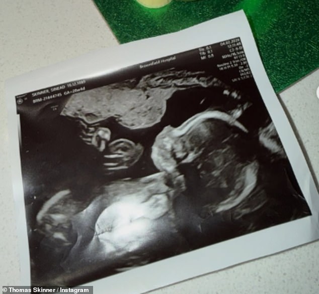 كشف النجم Strictly عن الخبر أثناء احتفاله أيضًا بعيد ميلاده الخامس والثلاثين، بعد اعترافه في سبتمبر من العام الماضي بخيانة زوجته بعد أسابيع فقط من عقد قرانهما.