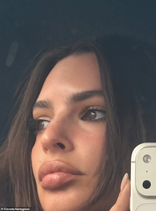 تضمن الجمال الذي ولد في كاليفورنيا صورة مقربة لوجهها الخالي من العيوب